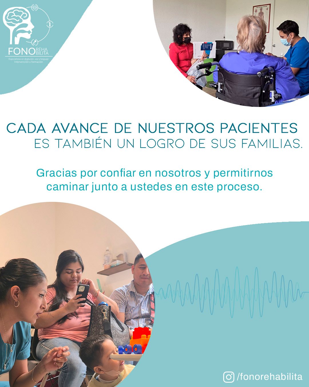 Dato sobre afasia y terapia de lenguaje